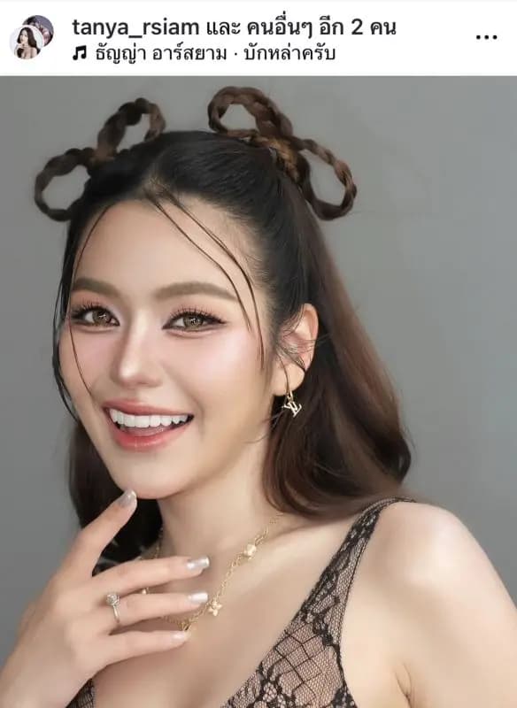 女歌手紧急入院!!无法转动脖子