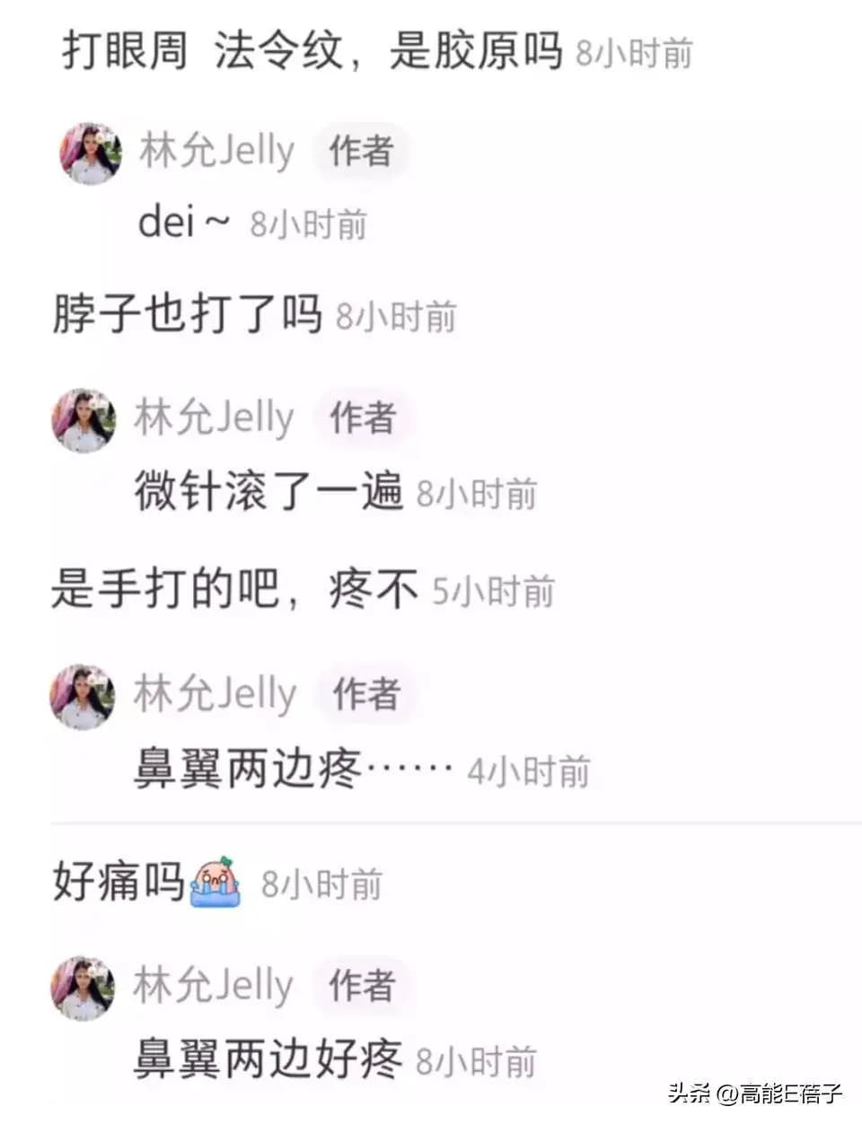 林允经常在社交平台分享医美护肤心得