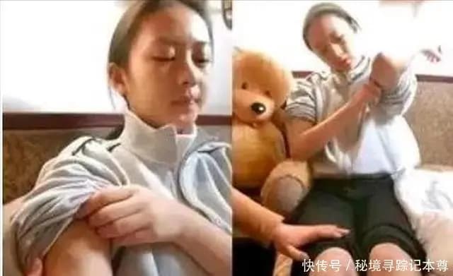 童瑶当年受伤后的画面,令人心疼