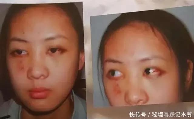 媒体报道童瑶与张默冲突事件的相关图片