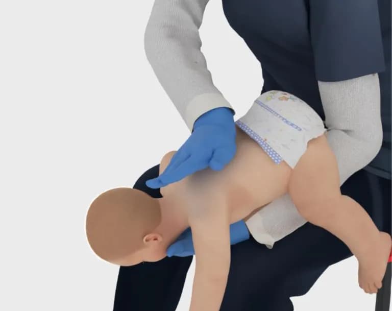 婴儿海姆立克急救背部拍击演示图