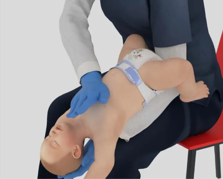 婴儿胸部冲击急救手法示意图